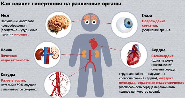 https://travmatolog.net/wp-content/uploads/2019/05/vliyanie-gipertonii.jpg
