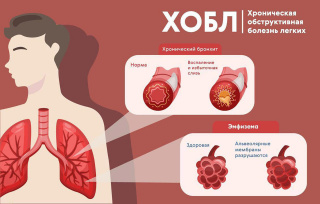 ХОБЛ — как помочь легким!